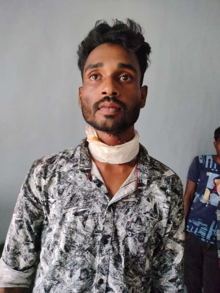 बाजार से लौट रहे दंपती पर नकाबपोश ने चाकू से किया हमला ,युवक के गले मे लगे 17 टाँके ,पुलिस जांच में जुटी